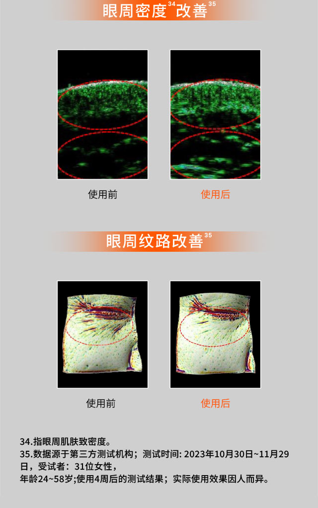 ag亚博科技|yabo sports|有限公司官网人参眼霜