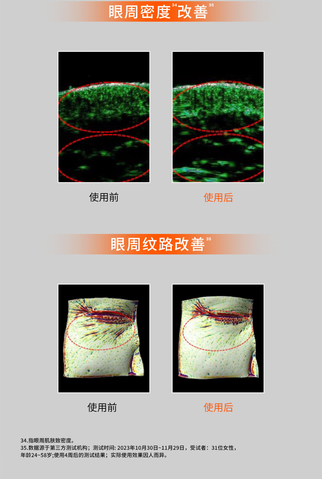 ag亚博科技|yabo sports|有限公司官网人参眼霜
